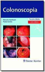 Colonoscopia