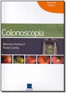Colonoscopia