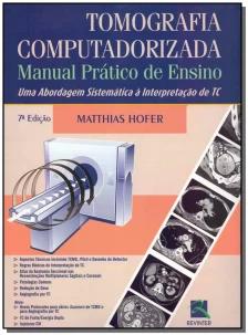 Tomografia Computadorizada